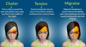 5 Ways to Get Rid of Headache